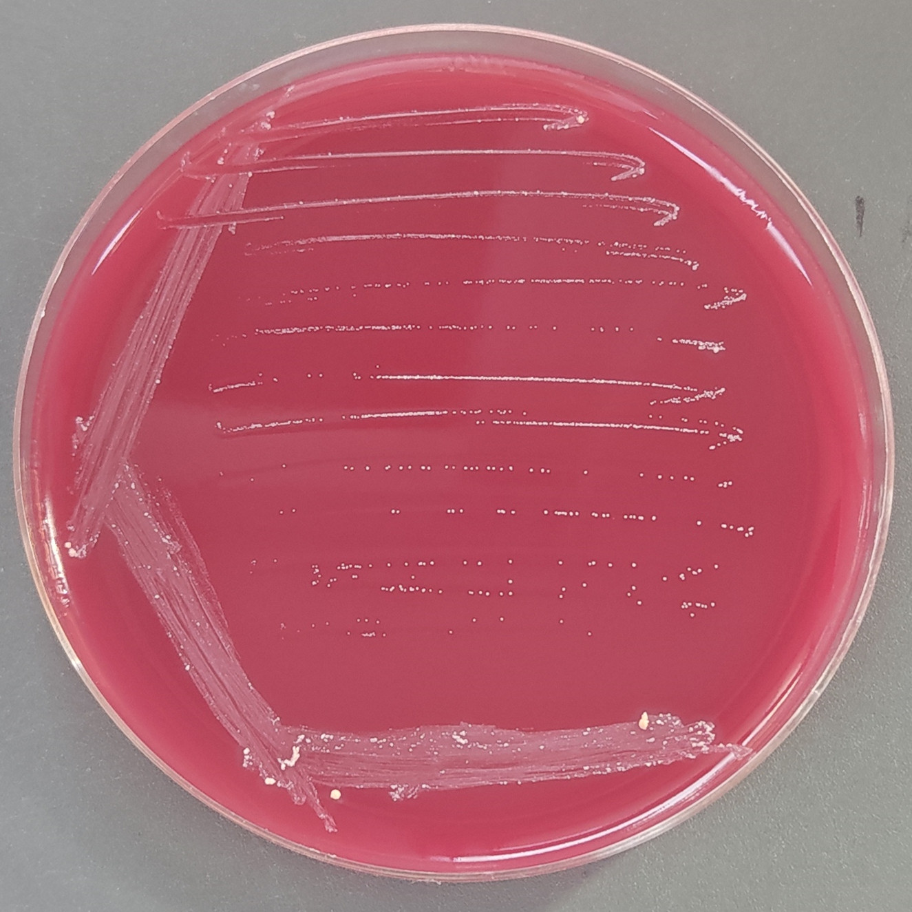 Hard rod-shaped bacteria-BNCC