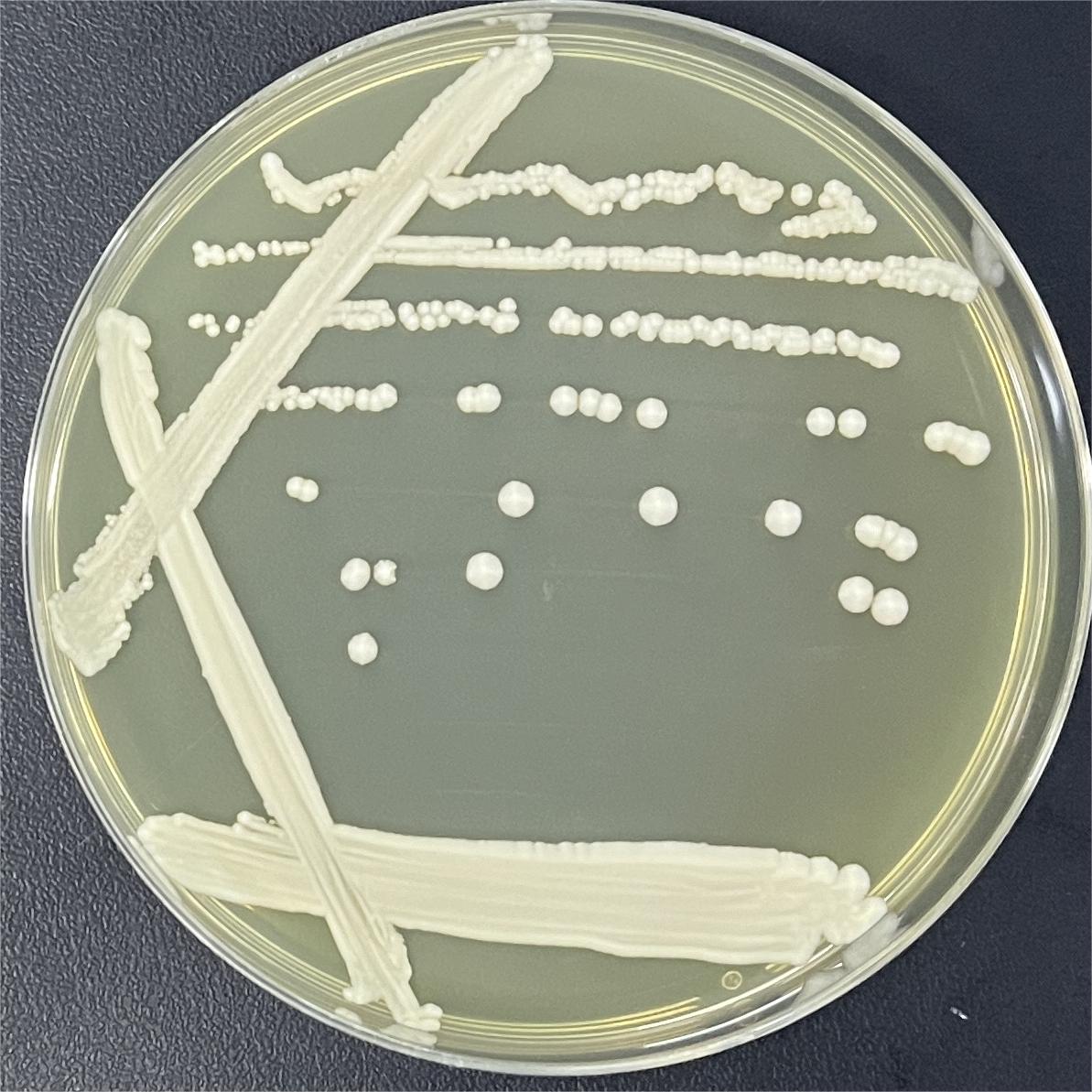 Saccharomyces cerevisiae-BNCC