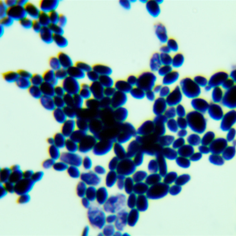 Candida albicans-BNCC