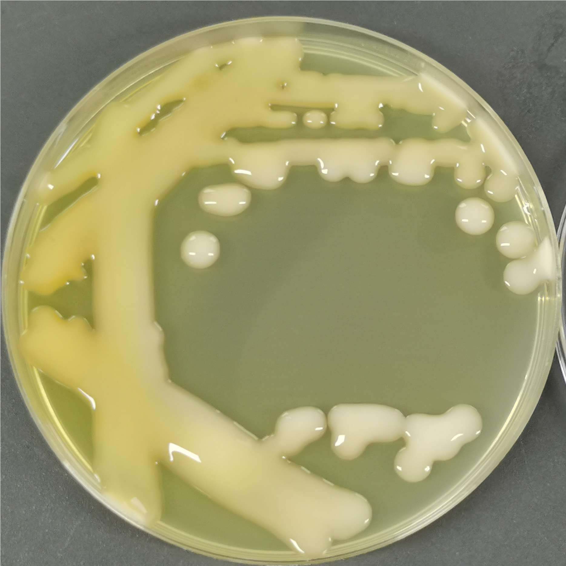 Cryptococcus vaginalis-BNCC