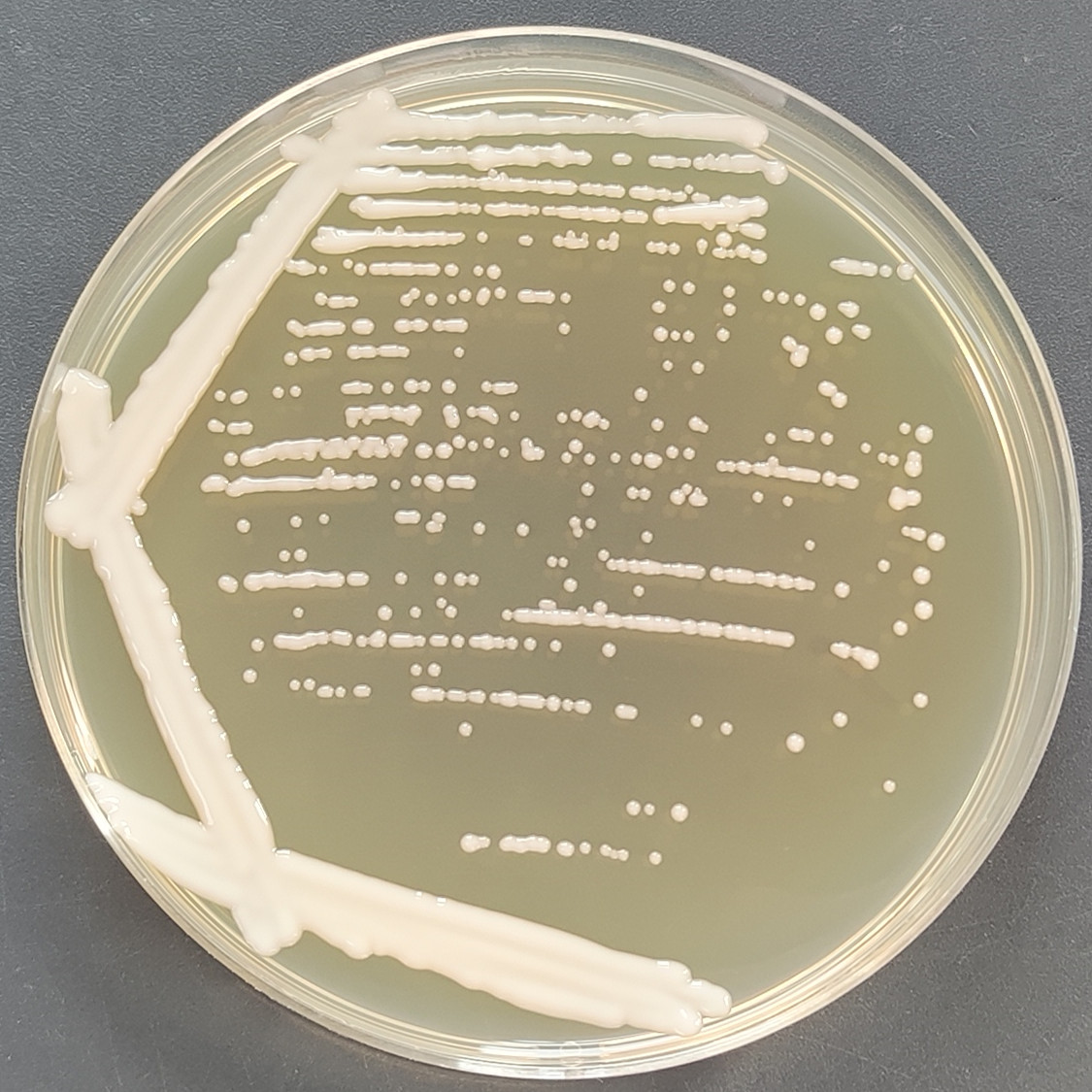 Cryptococcus vaginalis-BNCC