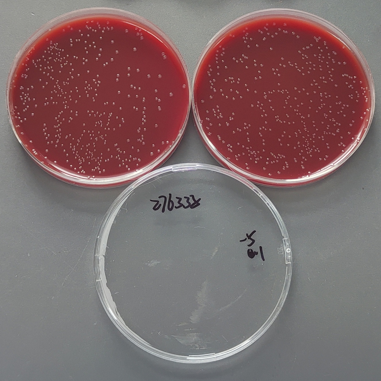 Neisseria gonorrhoeae-BNCC