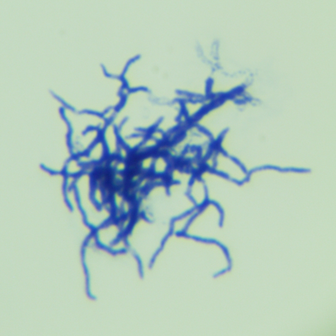 Nomura bacteria-BNCC