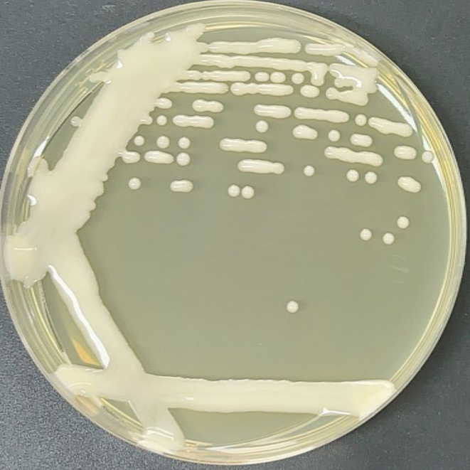 Cryptococcus vaginalis-BNCC