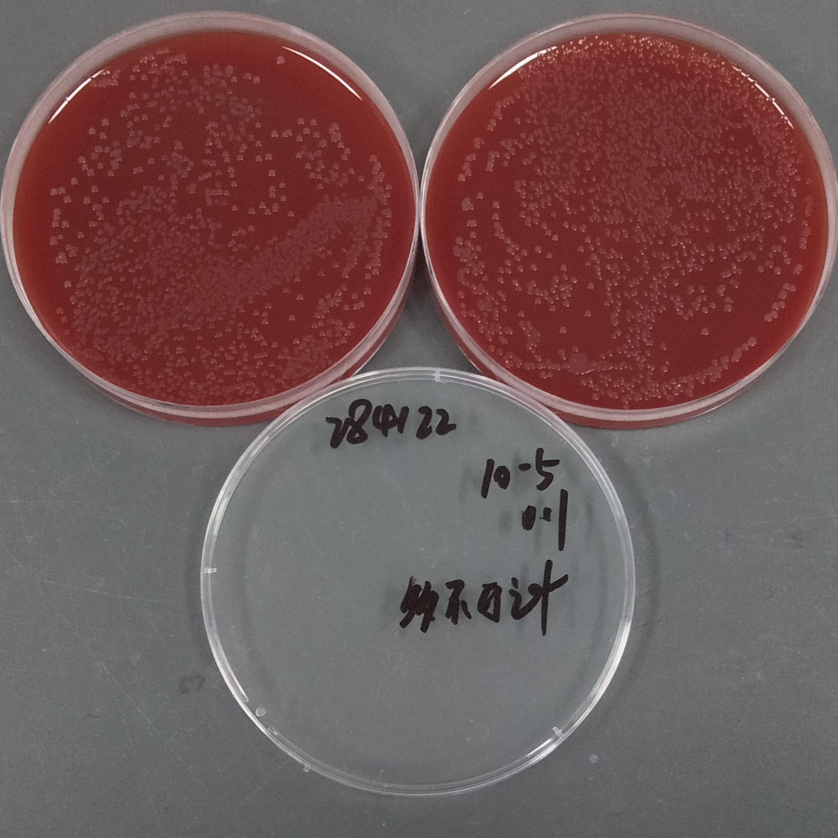 Neisseria gonorrhoeae-BNCC