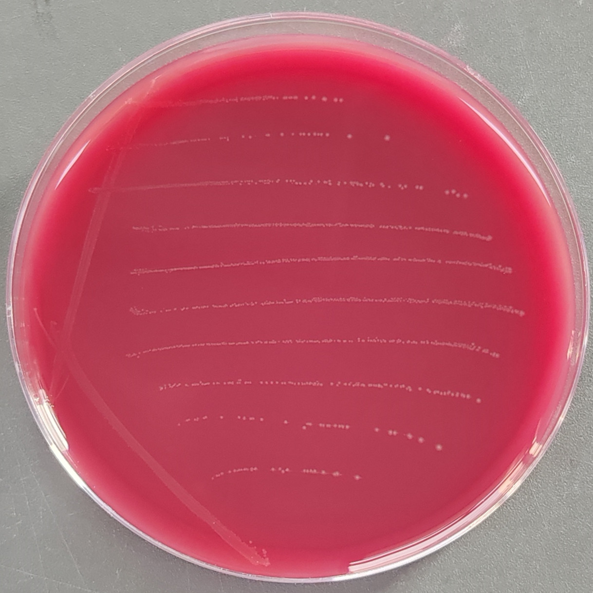Slow growth of Pseudomonas aeruginosa-BNCC