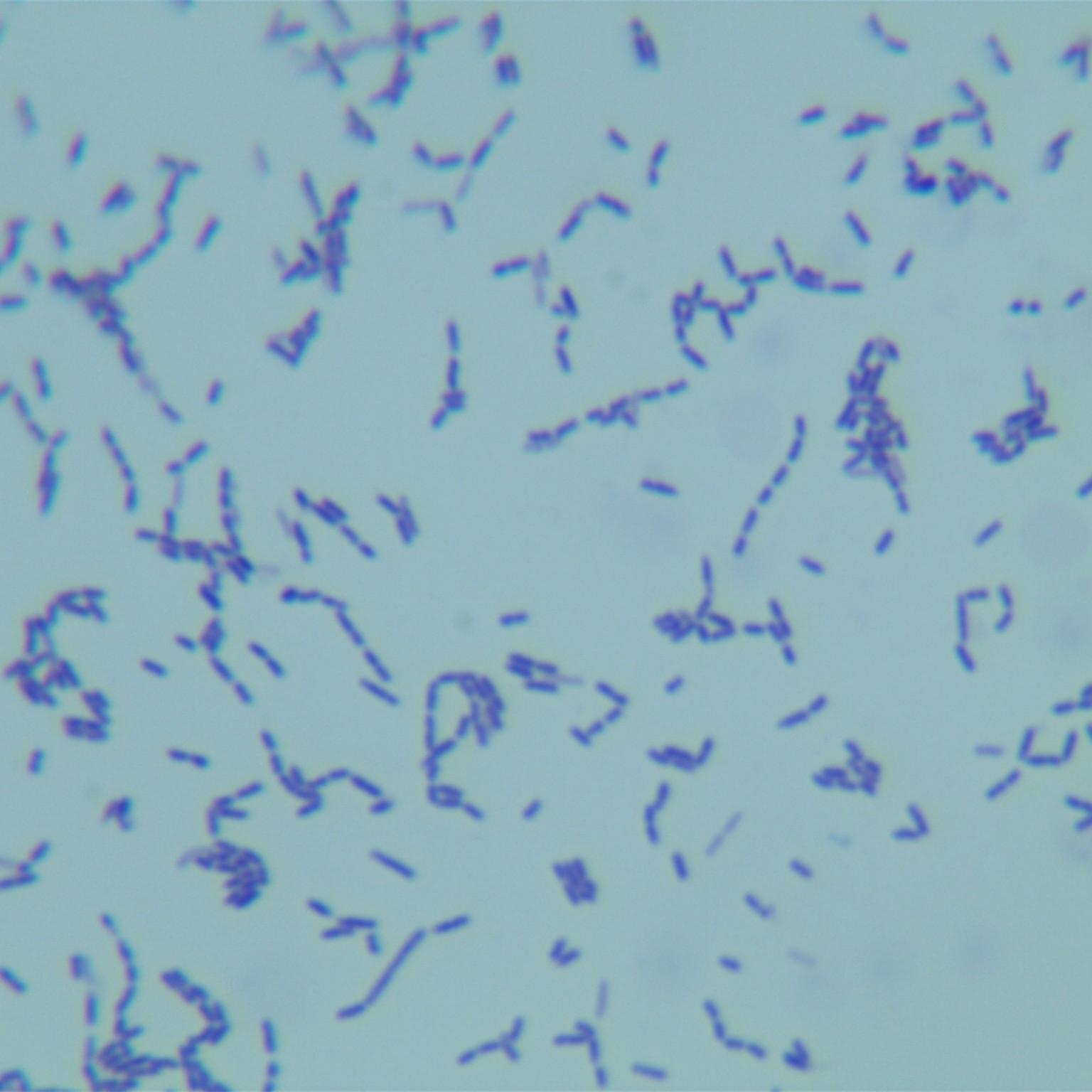 Slow growth of Pseudomonas aeruginosa-BNCC