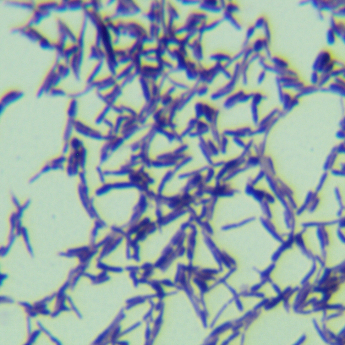 Pseudomonas aeruginosa 75iv2-BNCC