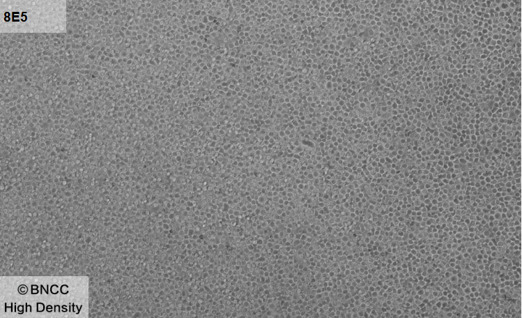 Human peripheral blood lymphocytes-BNCC