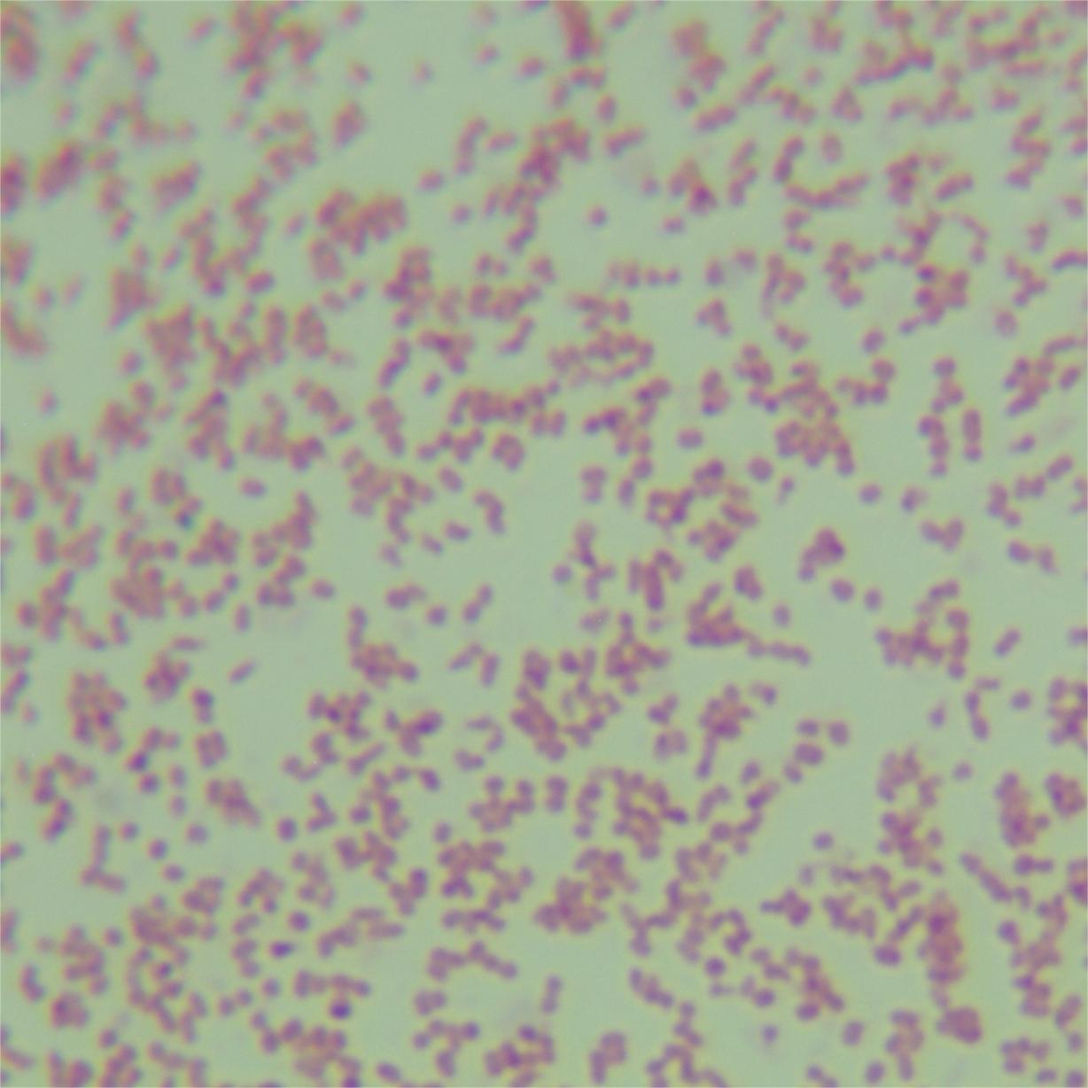 Salmonella enterica subsp. enteritis-BNCC