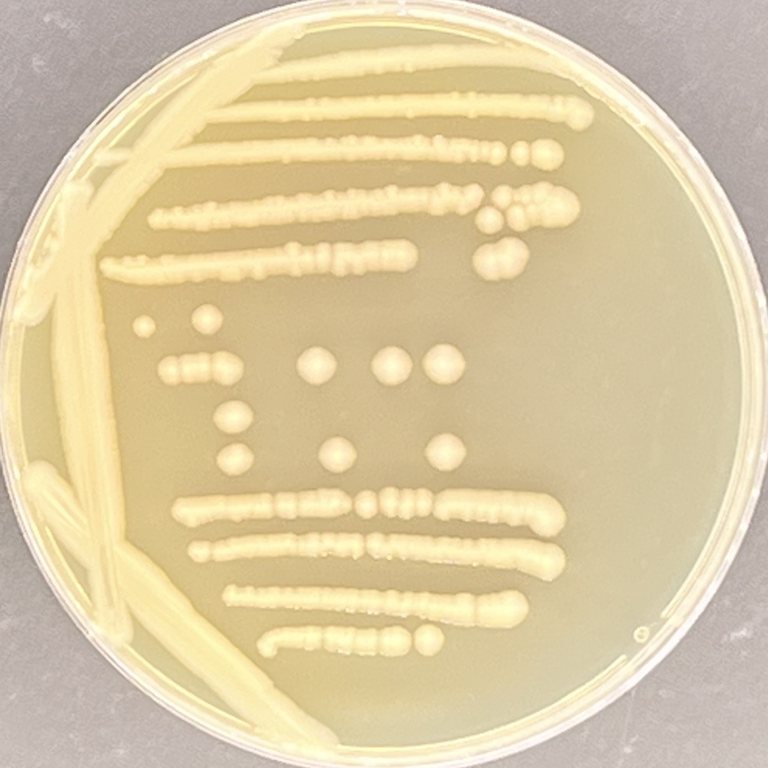 Salmonella enterica subsp. enteritis-BNCC
