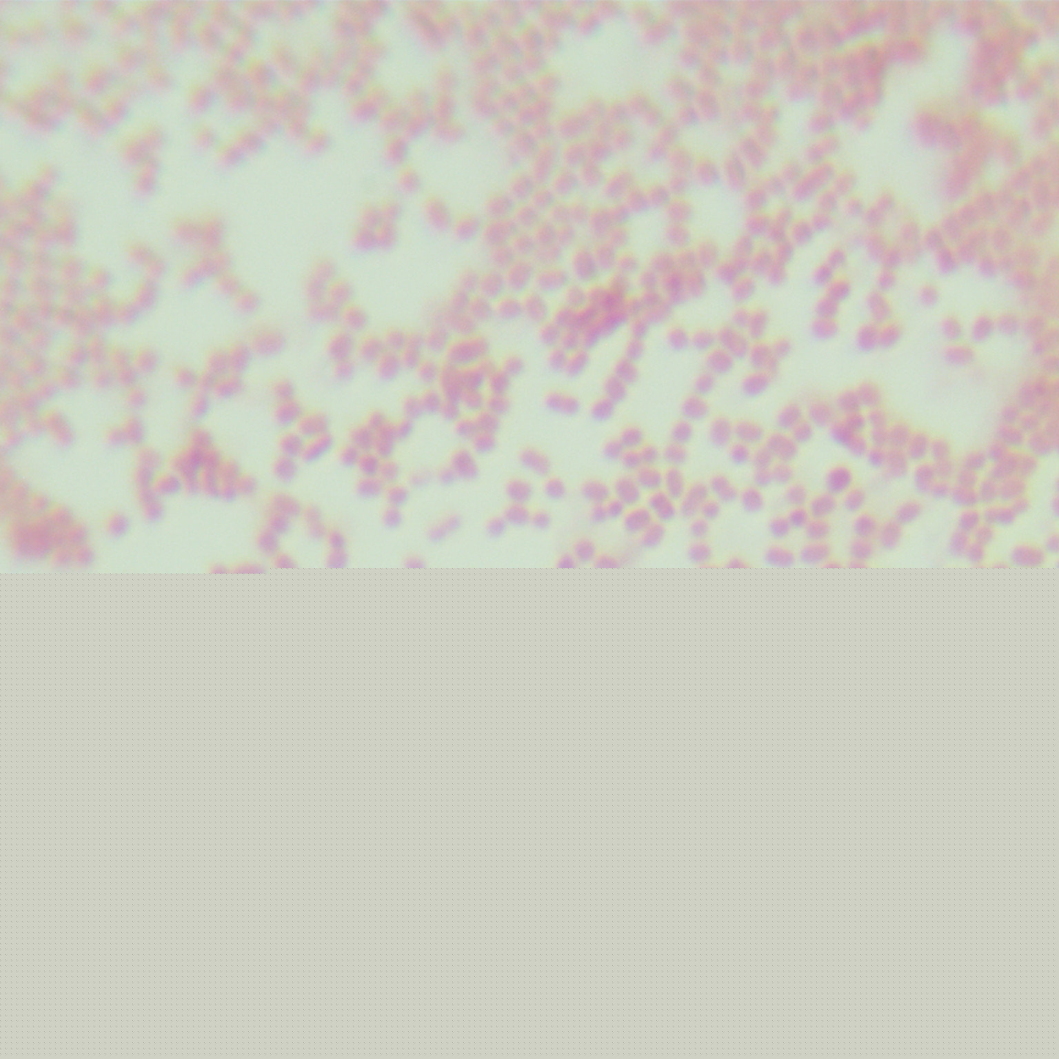 Salmonella enterica subsp. enterica-BNCC