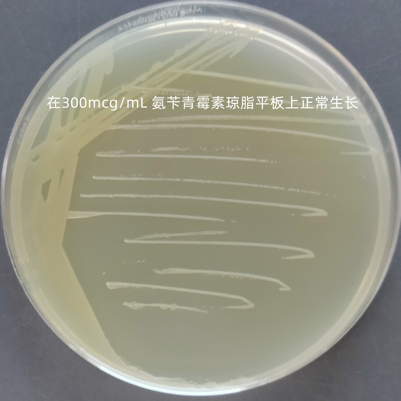 Pseudomonas aeruginosa-BNCC
