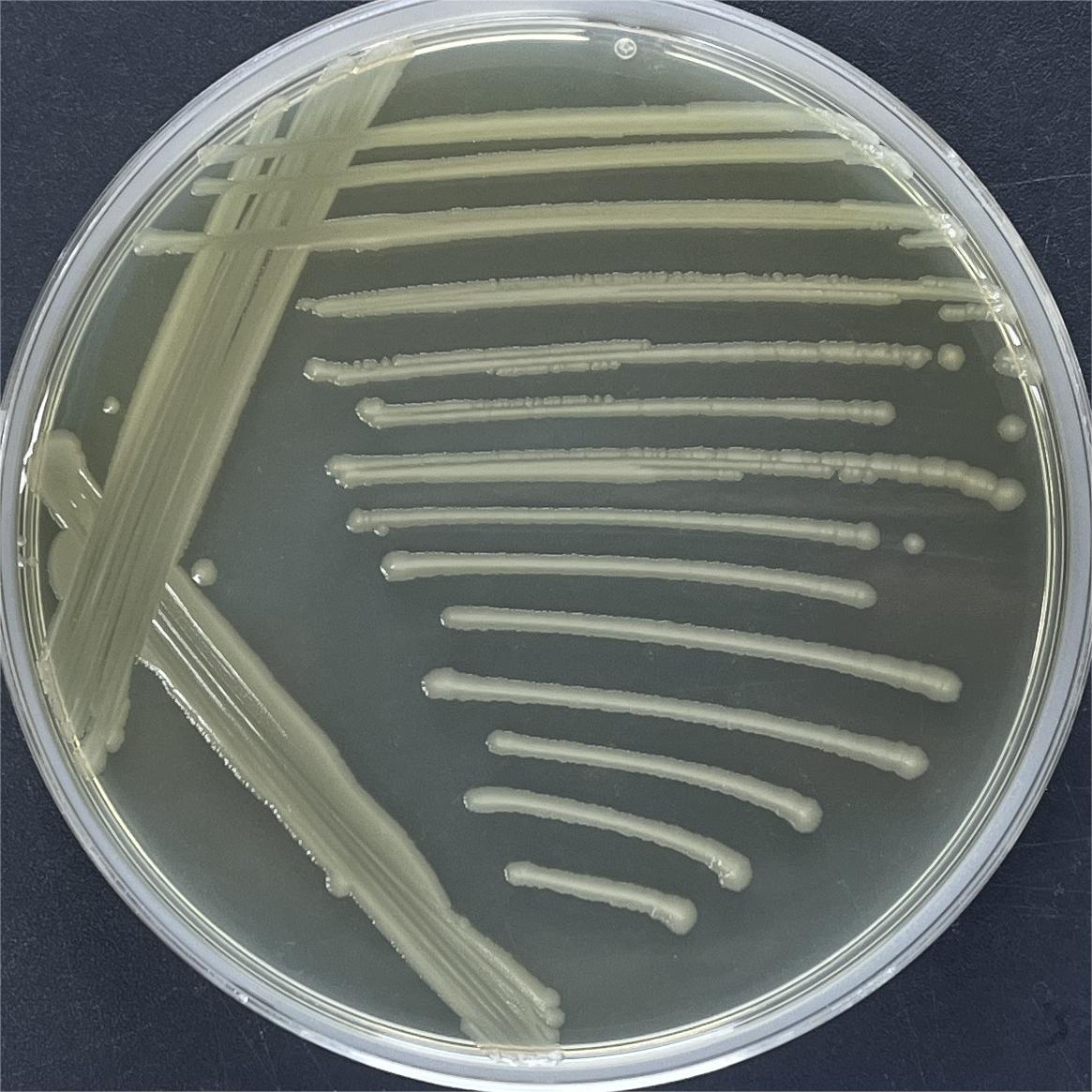 Song's Shigella-BNCC