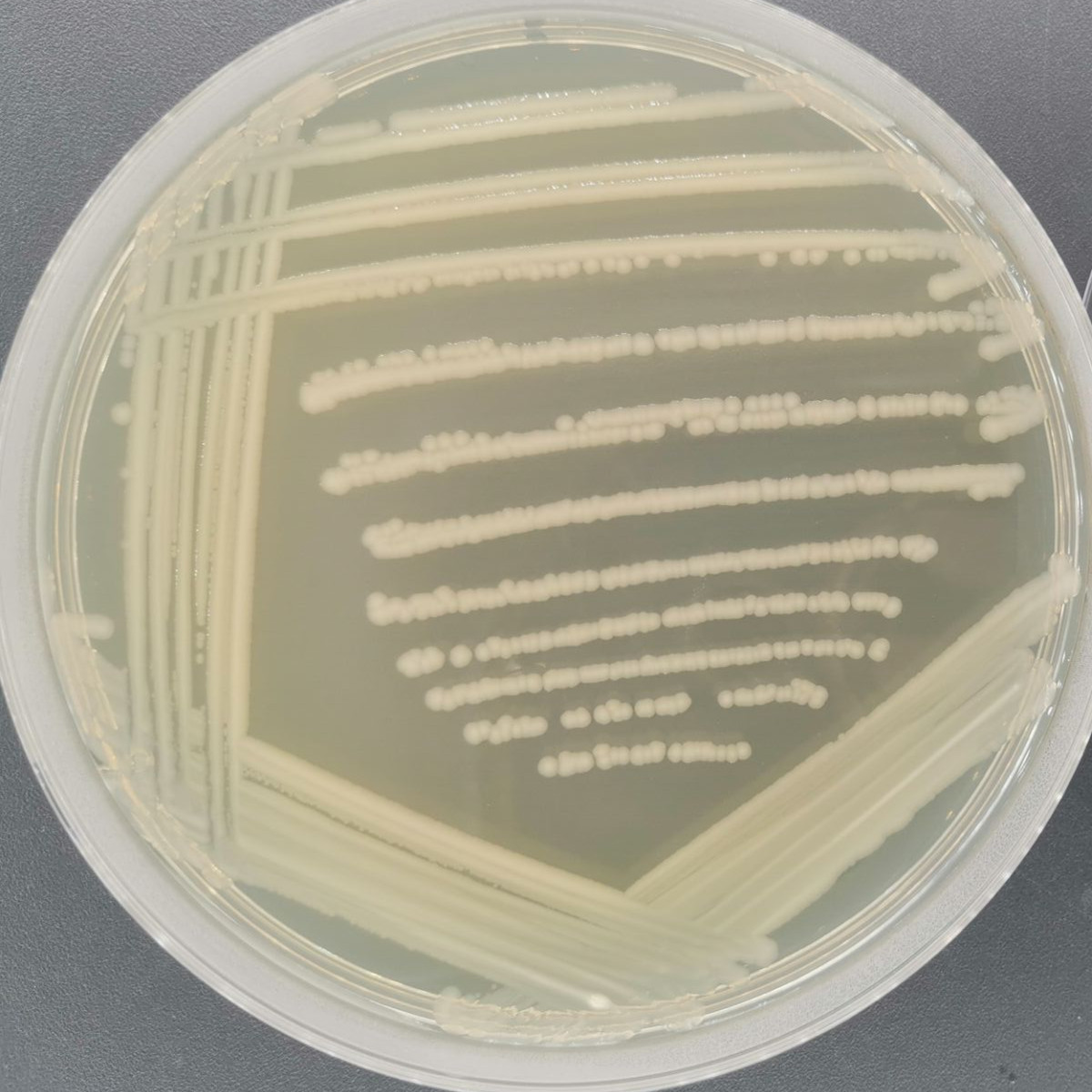 Salmonella Enteritidis-BNCC