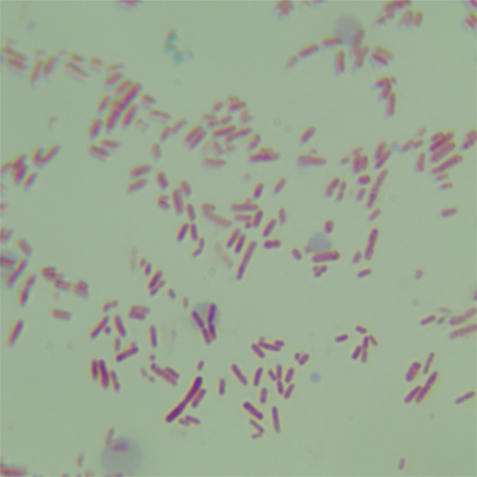 Photorhabdus luminescence-BNCC