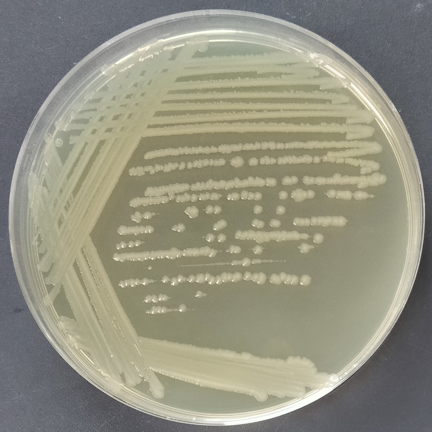 Salmonella subsp. enterica serotype A paratyphoid fever-BNCC