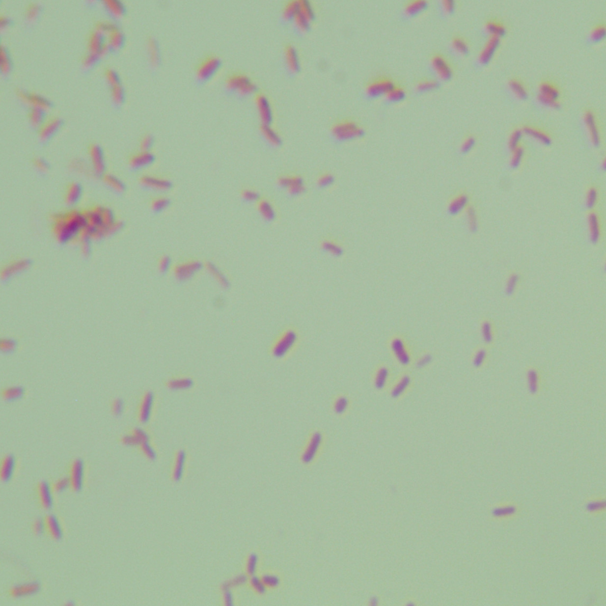 Salmonella subsp. enterica serotype A paratyphoid fever-BNCC