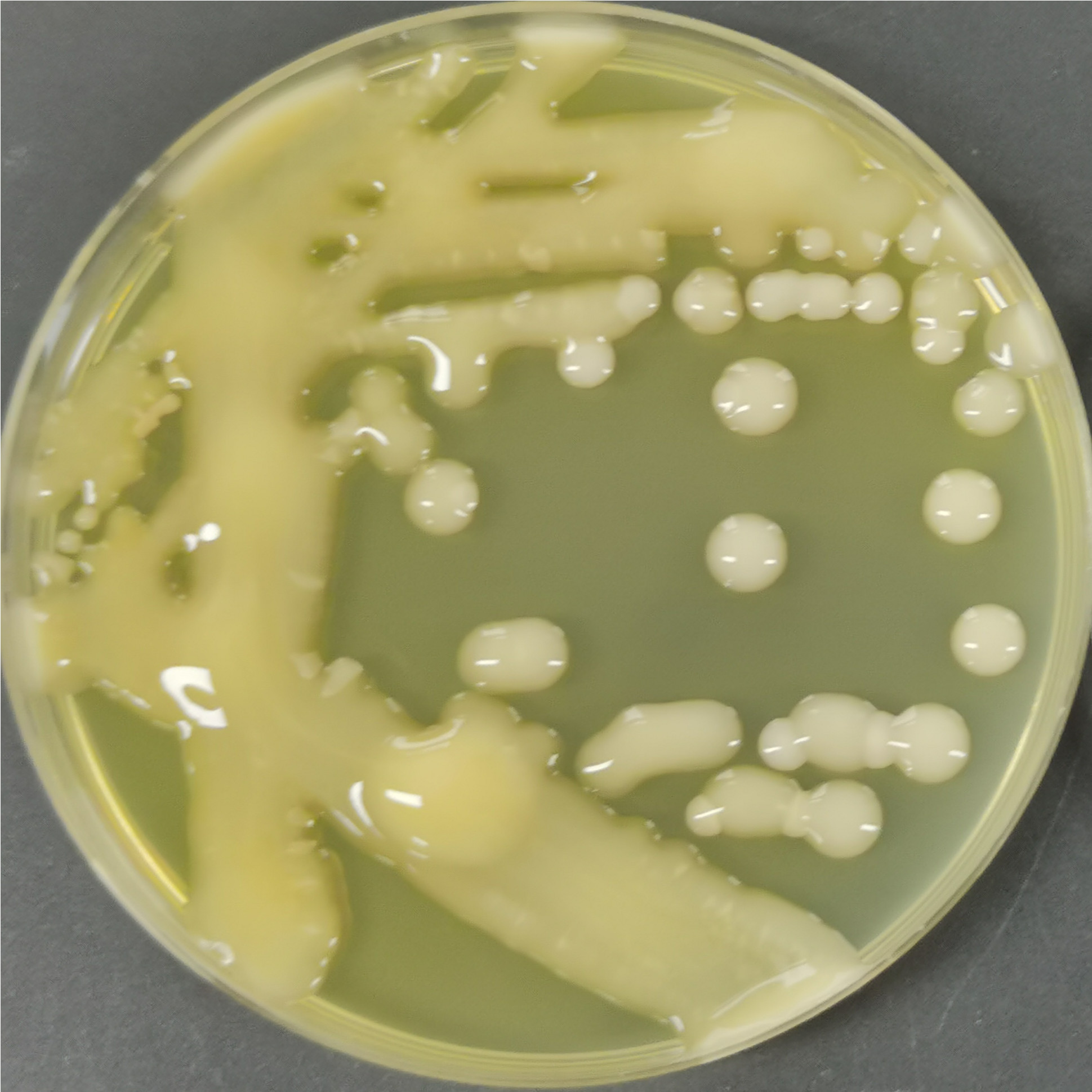 Cryptococcus vaginalis-BNCC