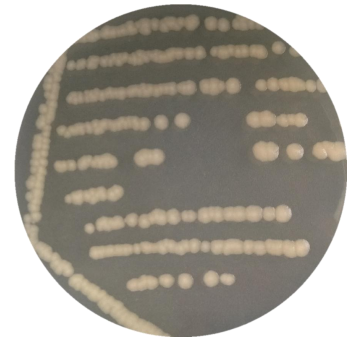 Stark Brown's Actinobacteria GPS11-BNCC