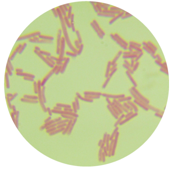 Stark Brown's Actinobacteria GPS11-BNCC