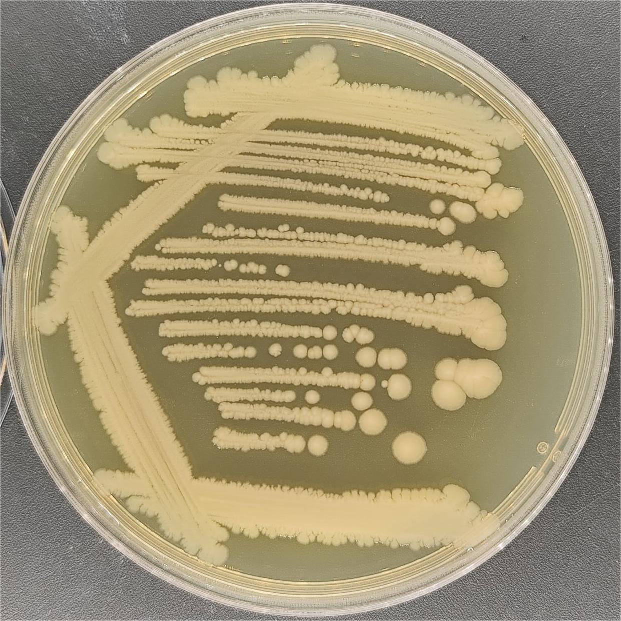 Escherichia coli (E. coli)-BNCC
