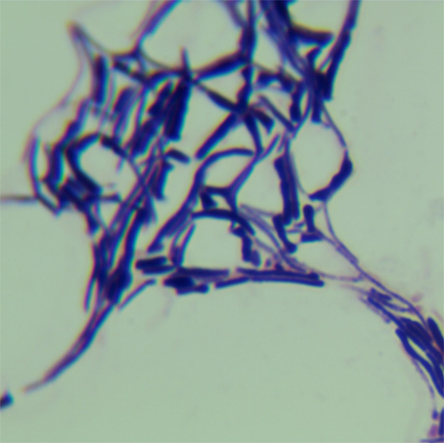 Streptomyces-BNCC