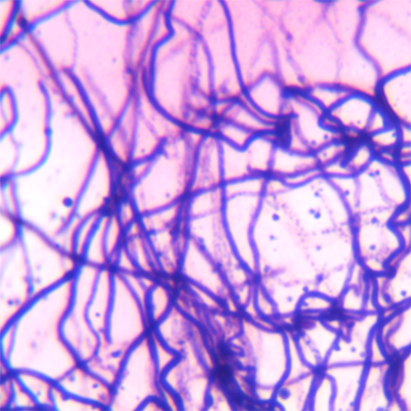 Streptomyces genus-BNCC