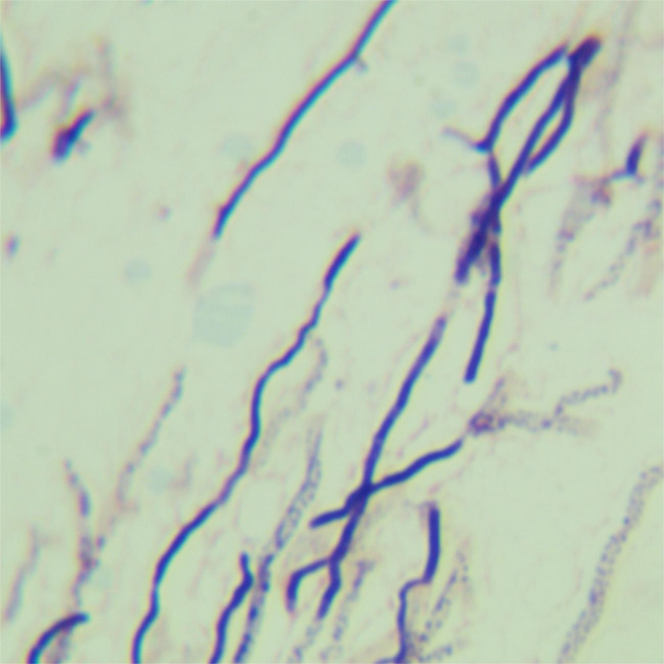 Streptomyces hygroscopicus-BNCC