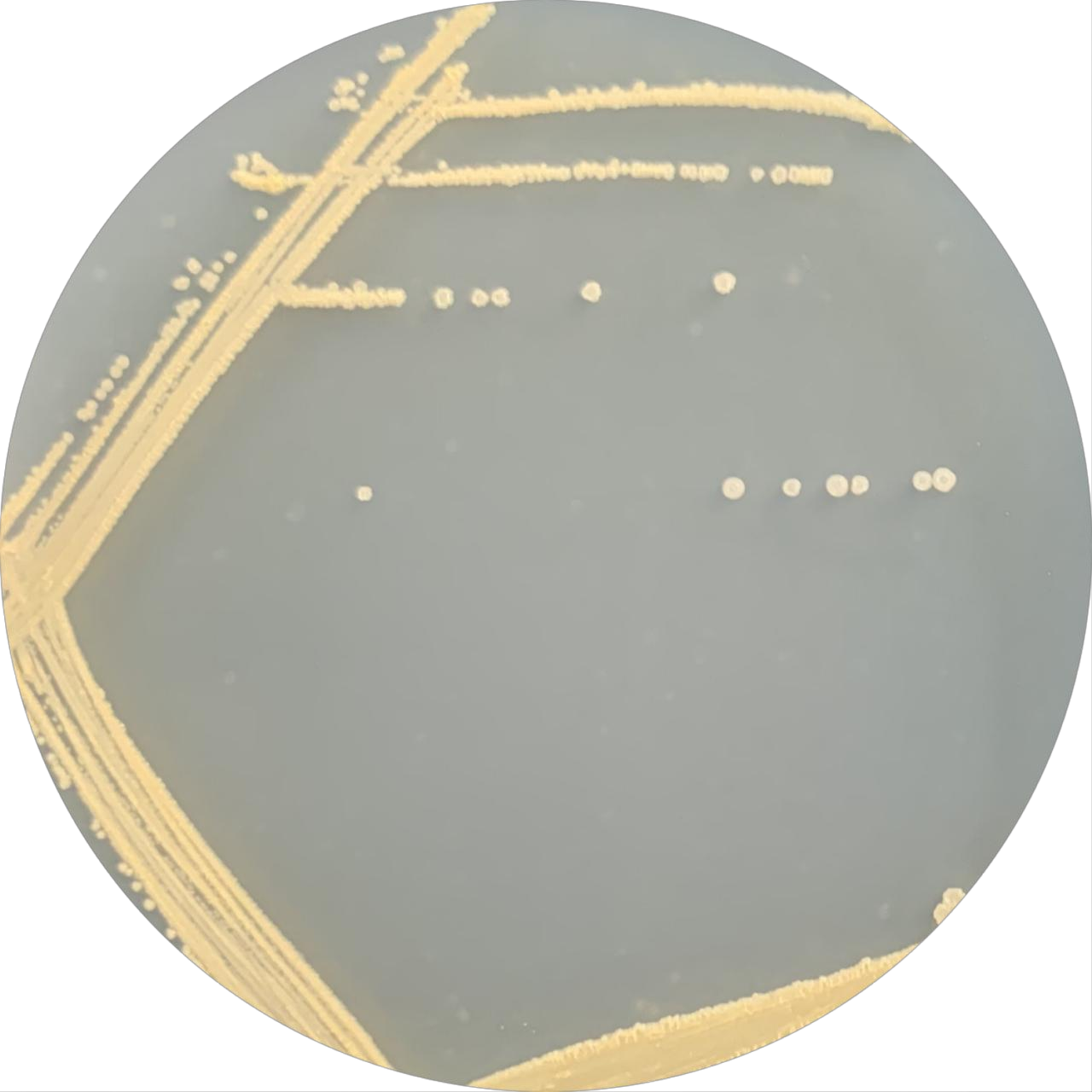 Streptomyces cracking-BNCC