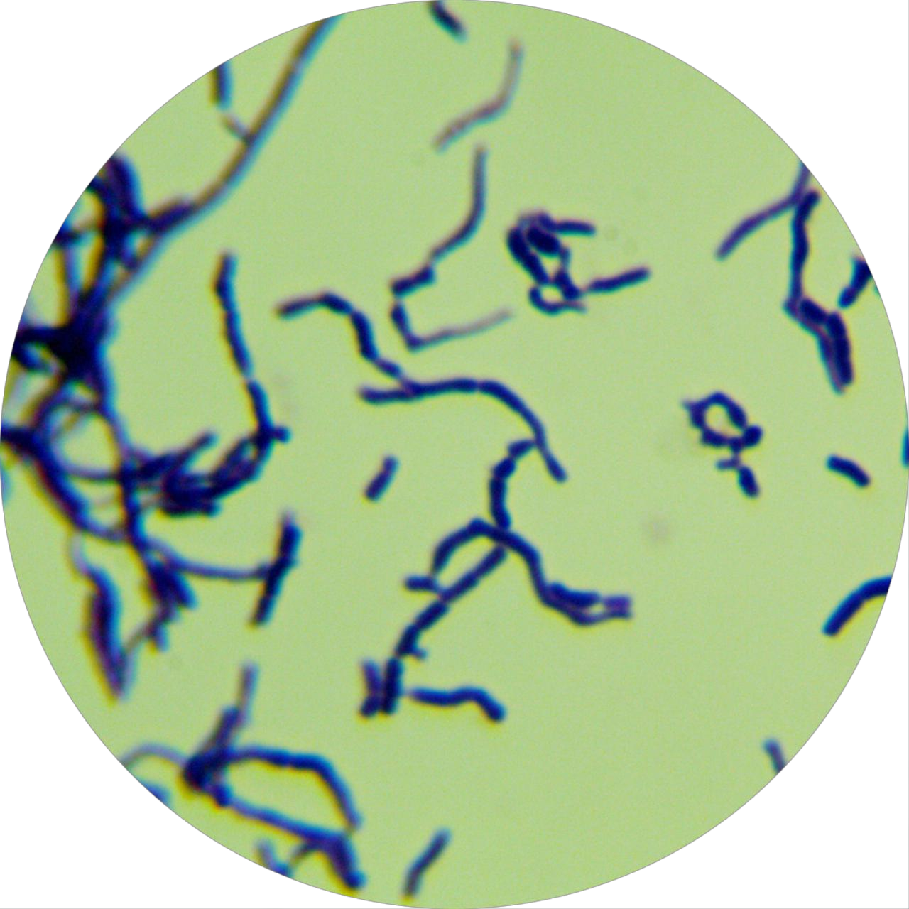 Streptomyces cracking-BNCC