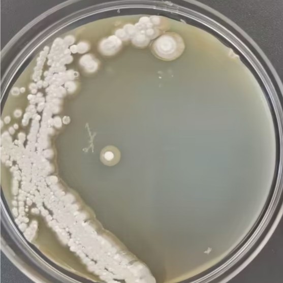Streptomyces coelicolor-BNCC