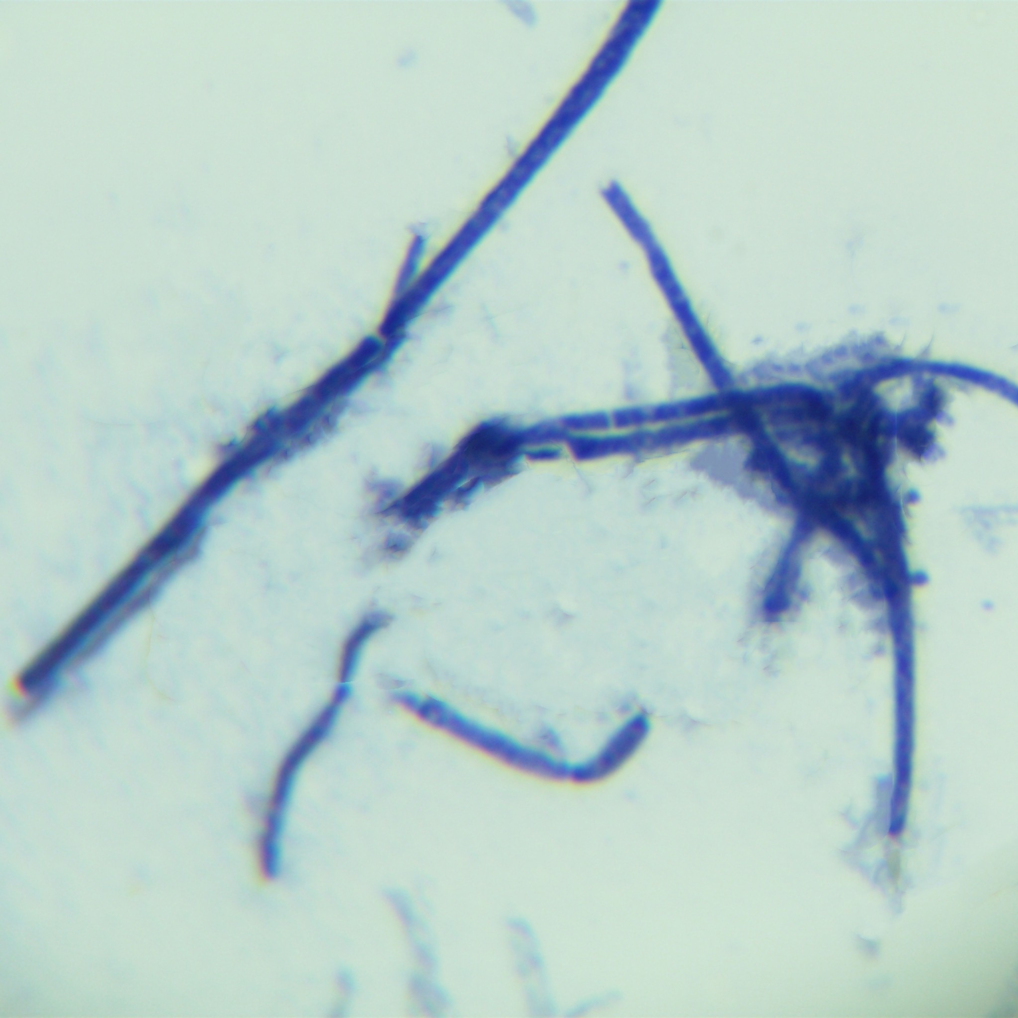 Streptomyces coelicolor-BNCC