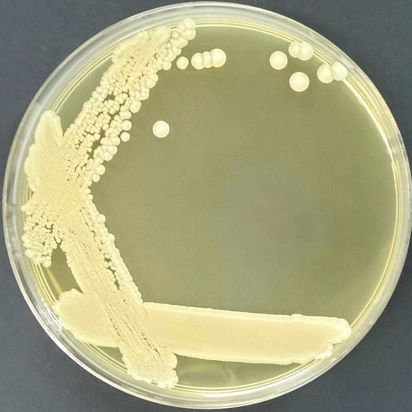 Baker's yeast-BNCC