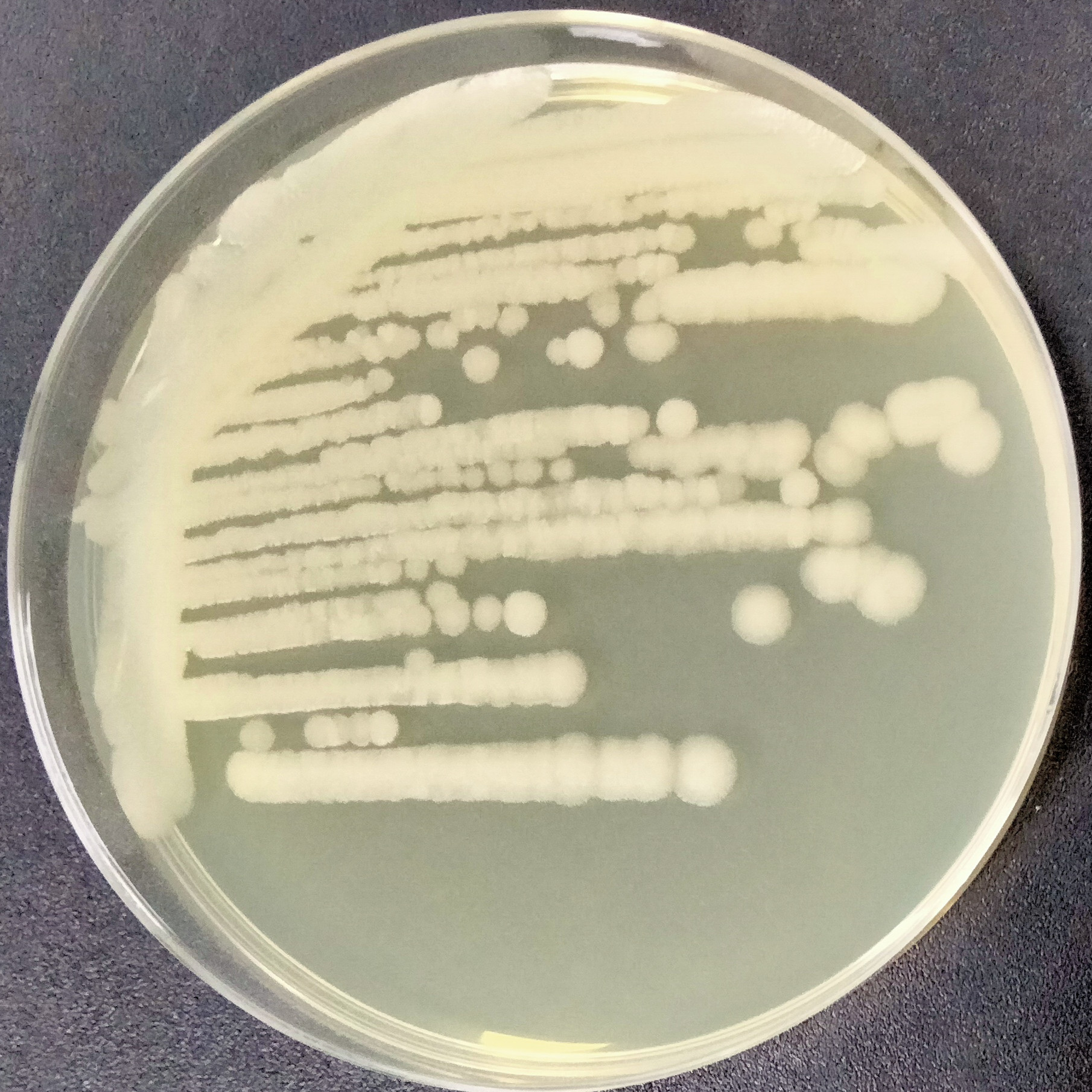Bacillus thuringiensis-BNCC