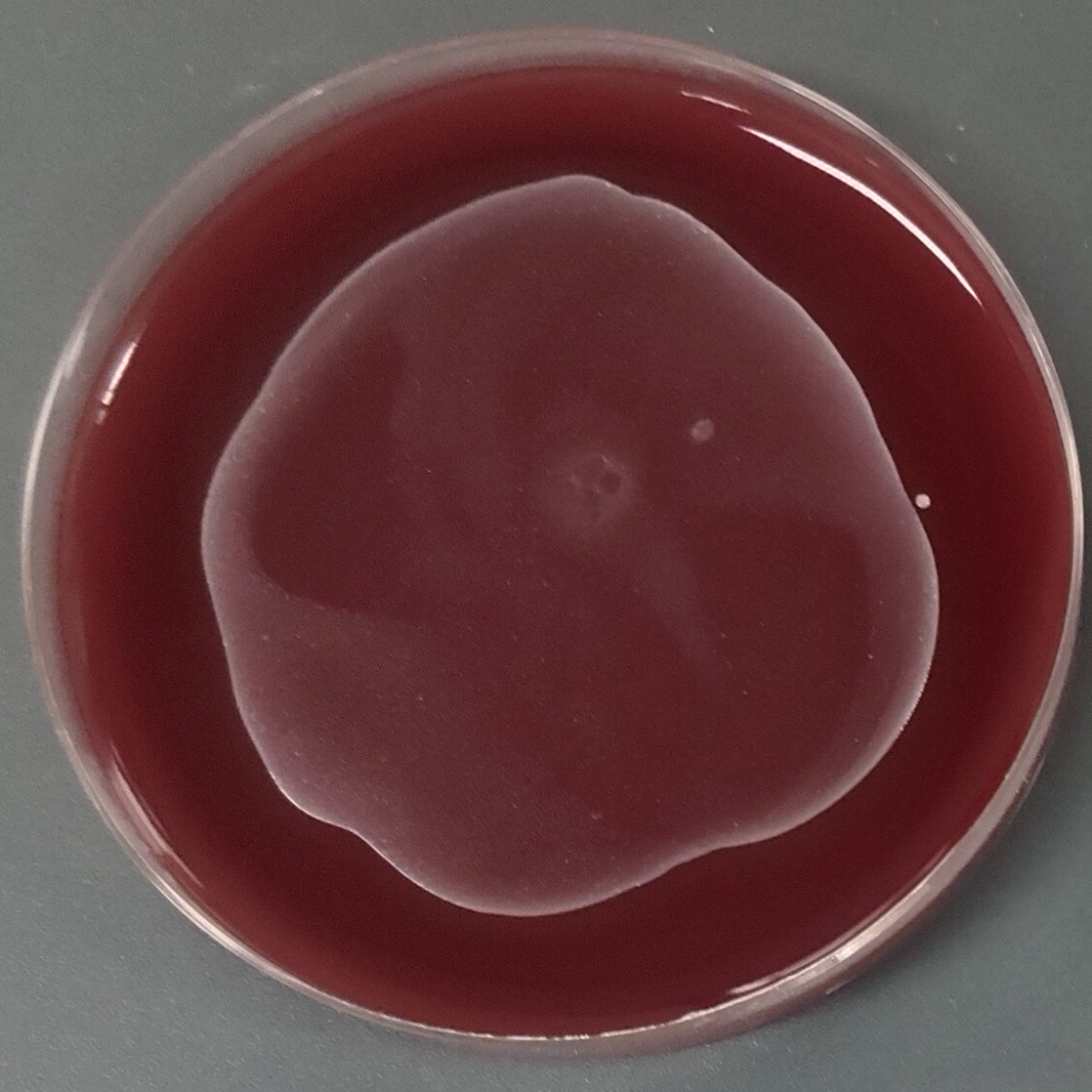 Propionibacterium acnes (Propionibacterium acnes, Propionibacterium acnes)-BNCC