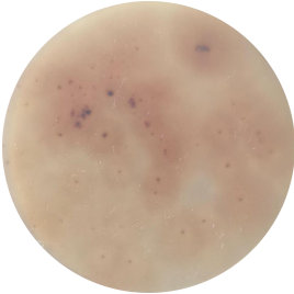 Cryptosporidium-BNCC