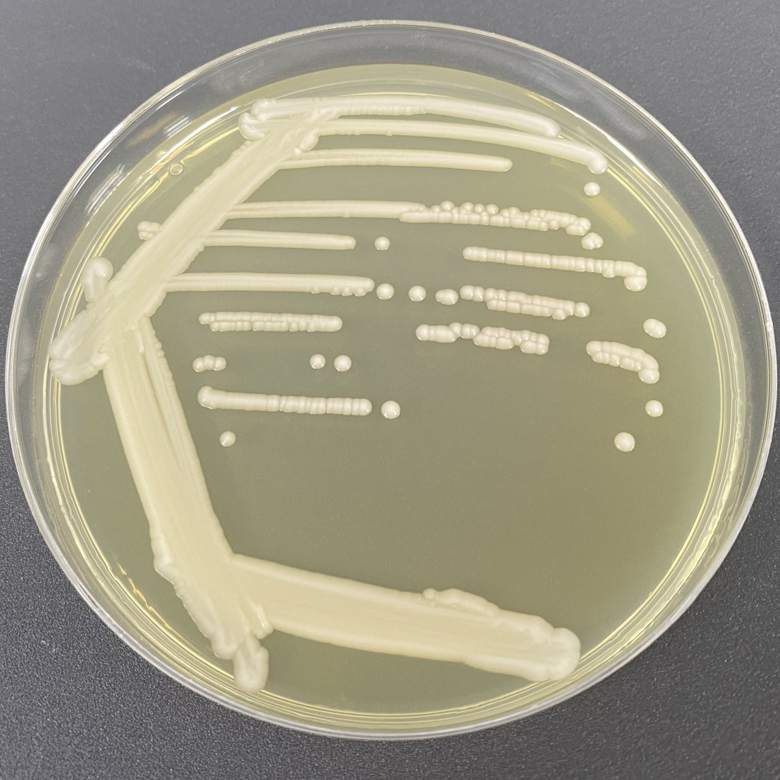 Jeding Seiberlindner's yeast-BNCC
