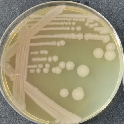 Escherichia coli-BNCC