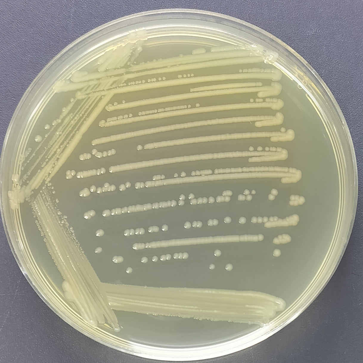 Escherichia coli (E. coli)-BNCC