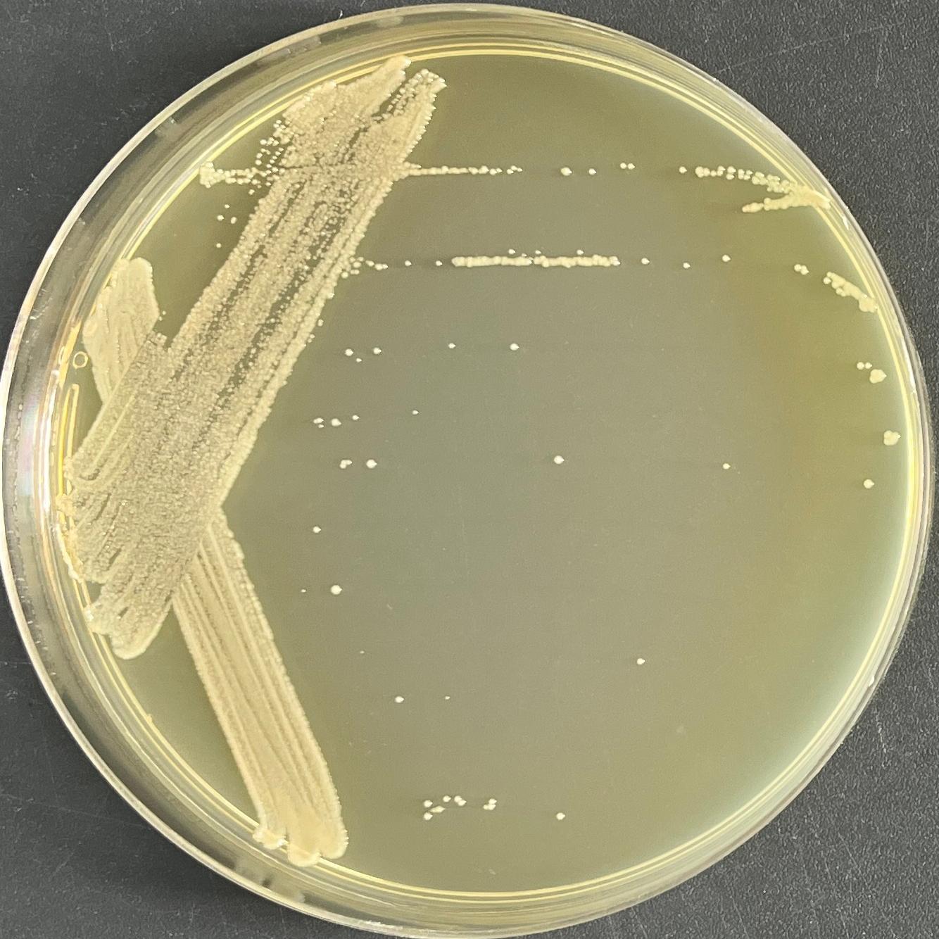 Shortwave Pseudomonas aeruginosa-BNCC