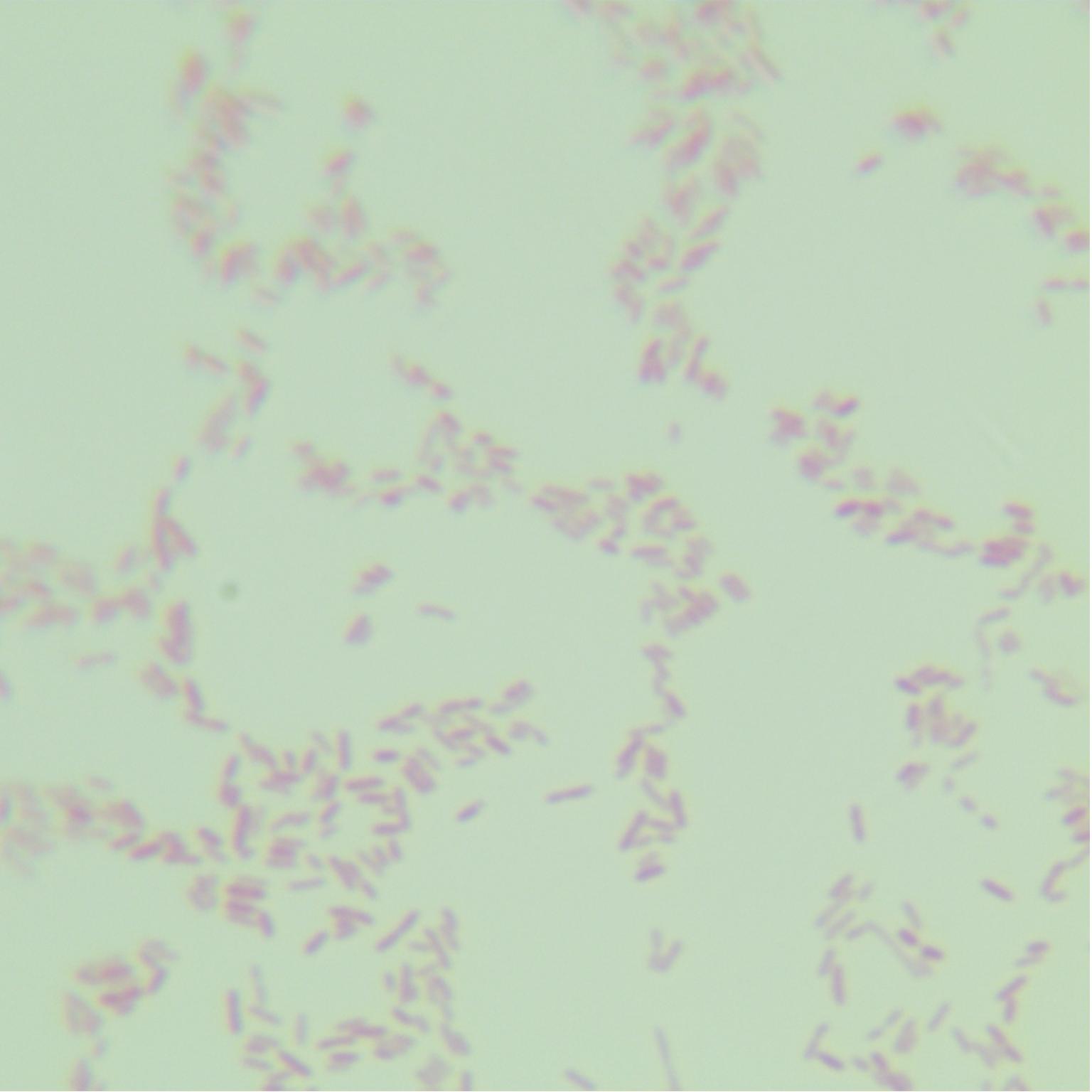 Shortwave Pseudomonas aeruginosa-BNCC