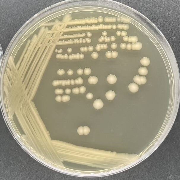 Escherichia coli (E. coli)-BNCC