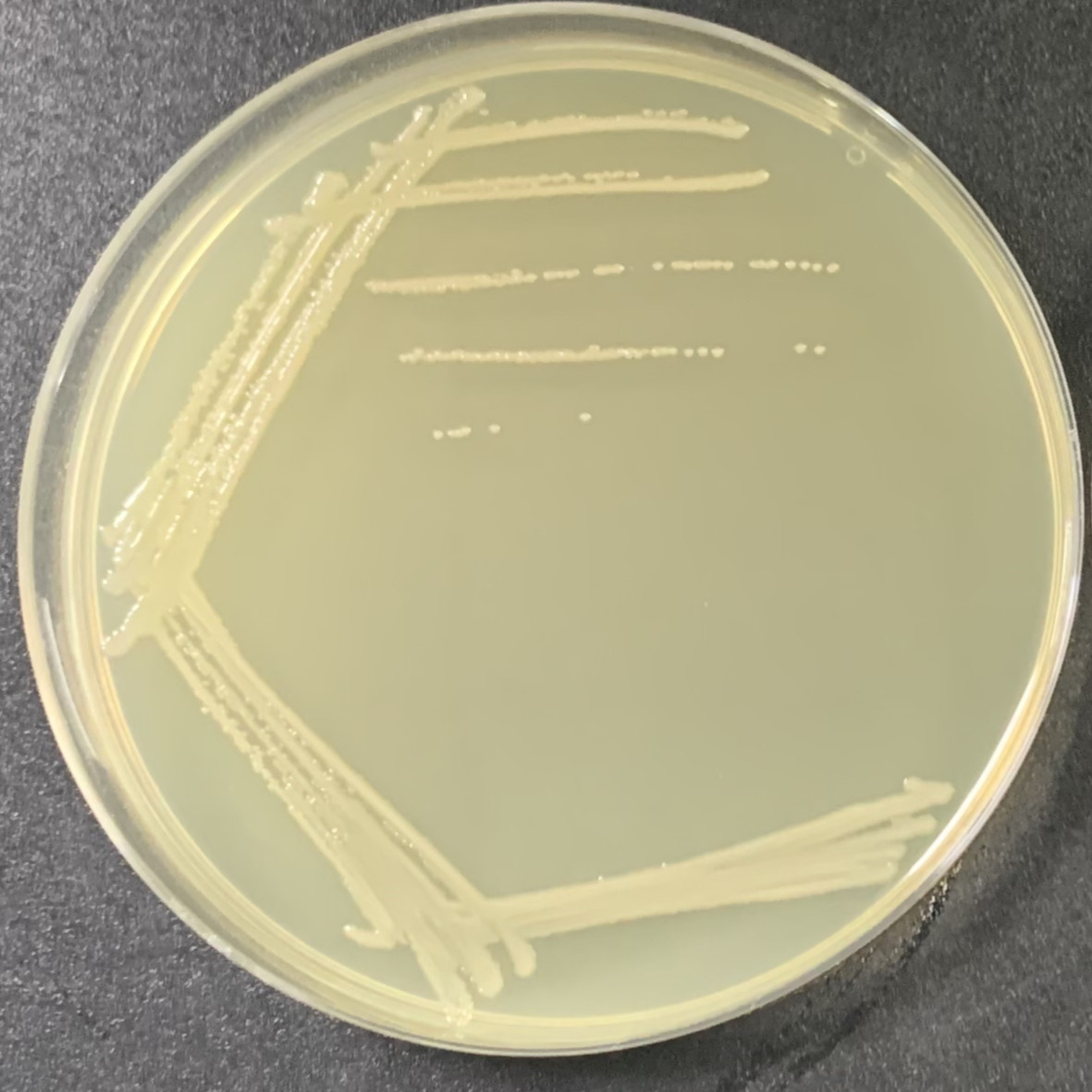 Serratia marcescens-BNCC