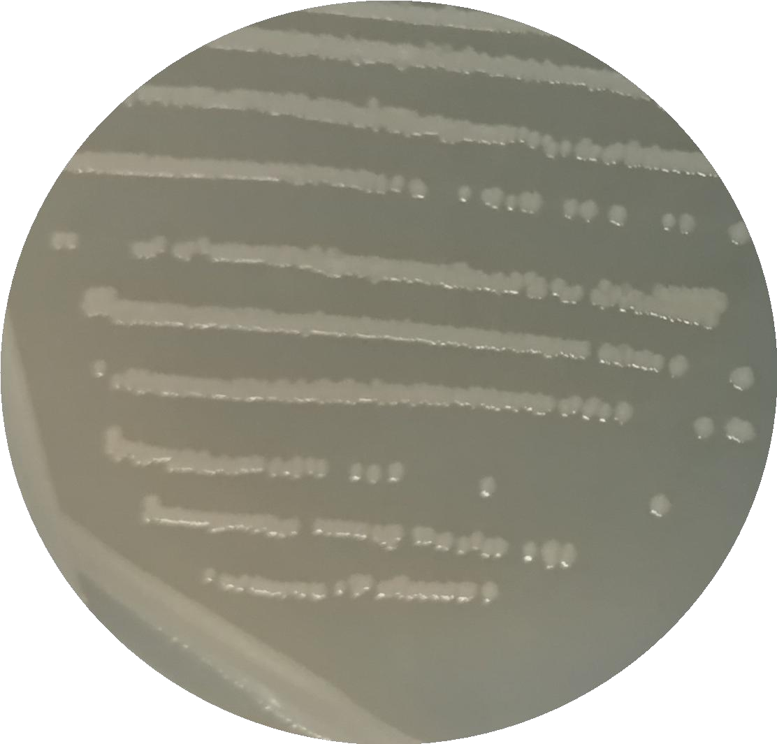 Salmonella enterica serovar Enteritidis-BNCC