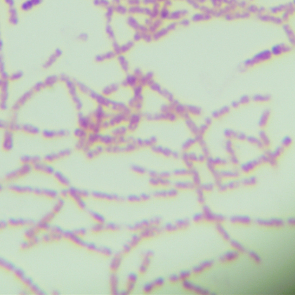 Floating jersey bacteria-BNCC