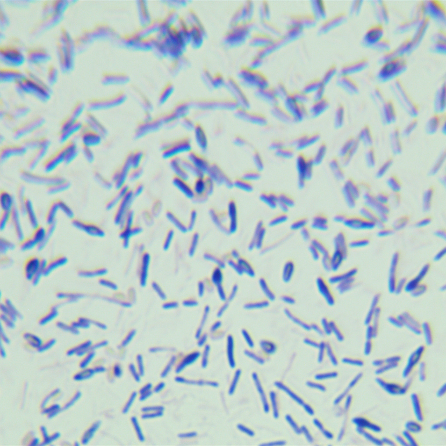 Acidic soil cyclic acid Bacillus-BNCC