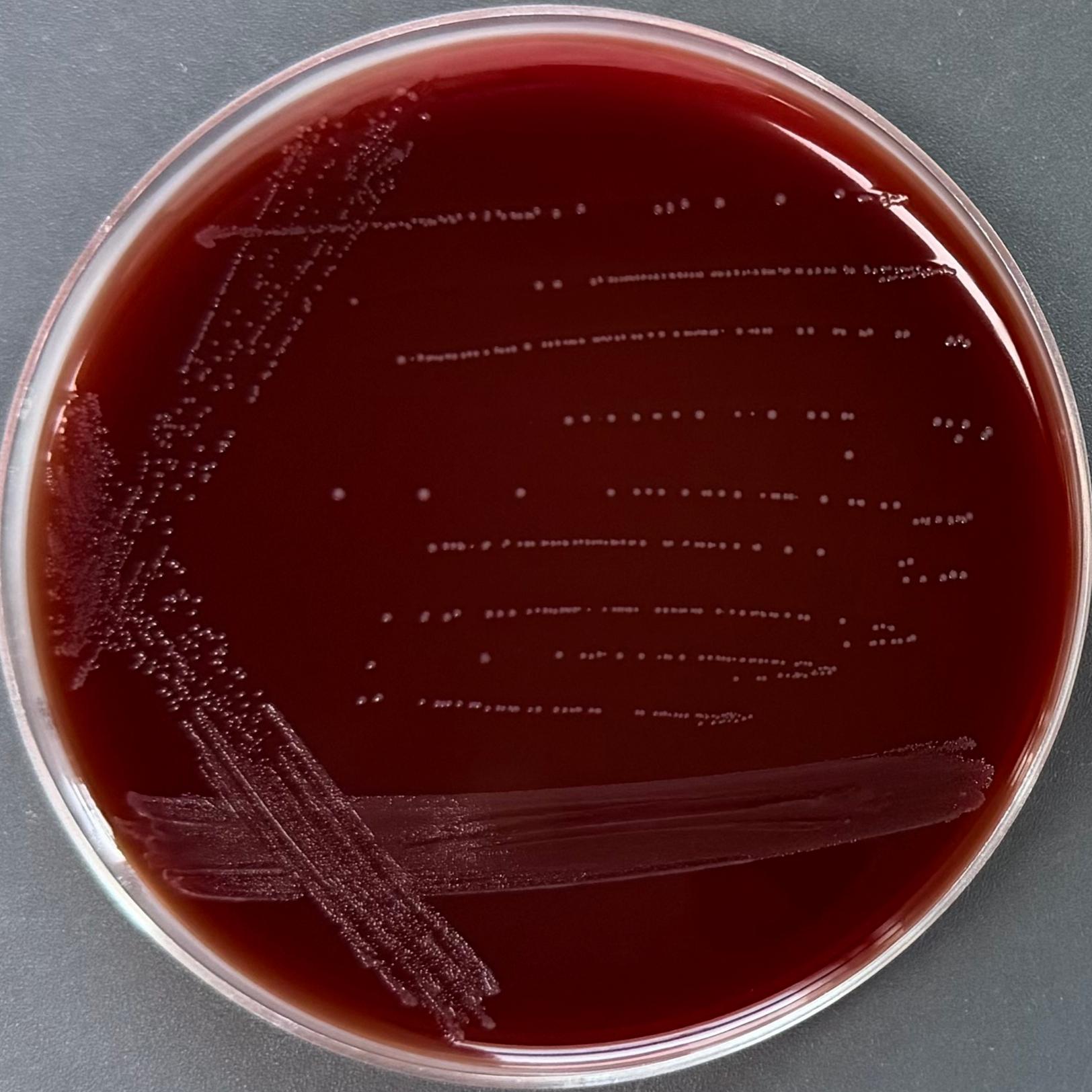 Vibrio harzianum-BNCC