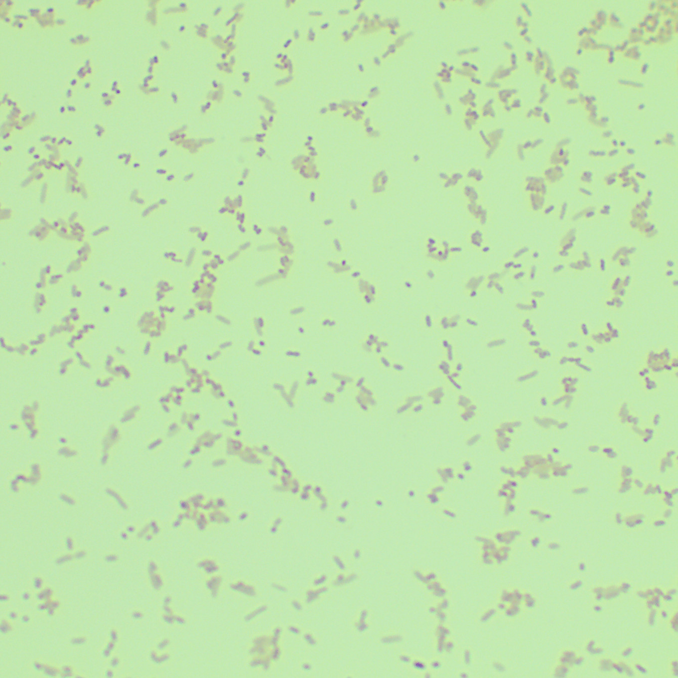 Fragile pseudomonas-BNCC