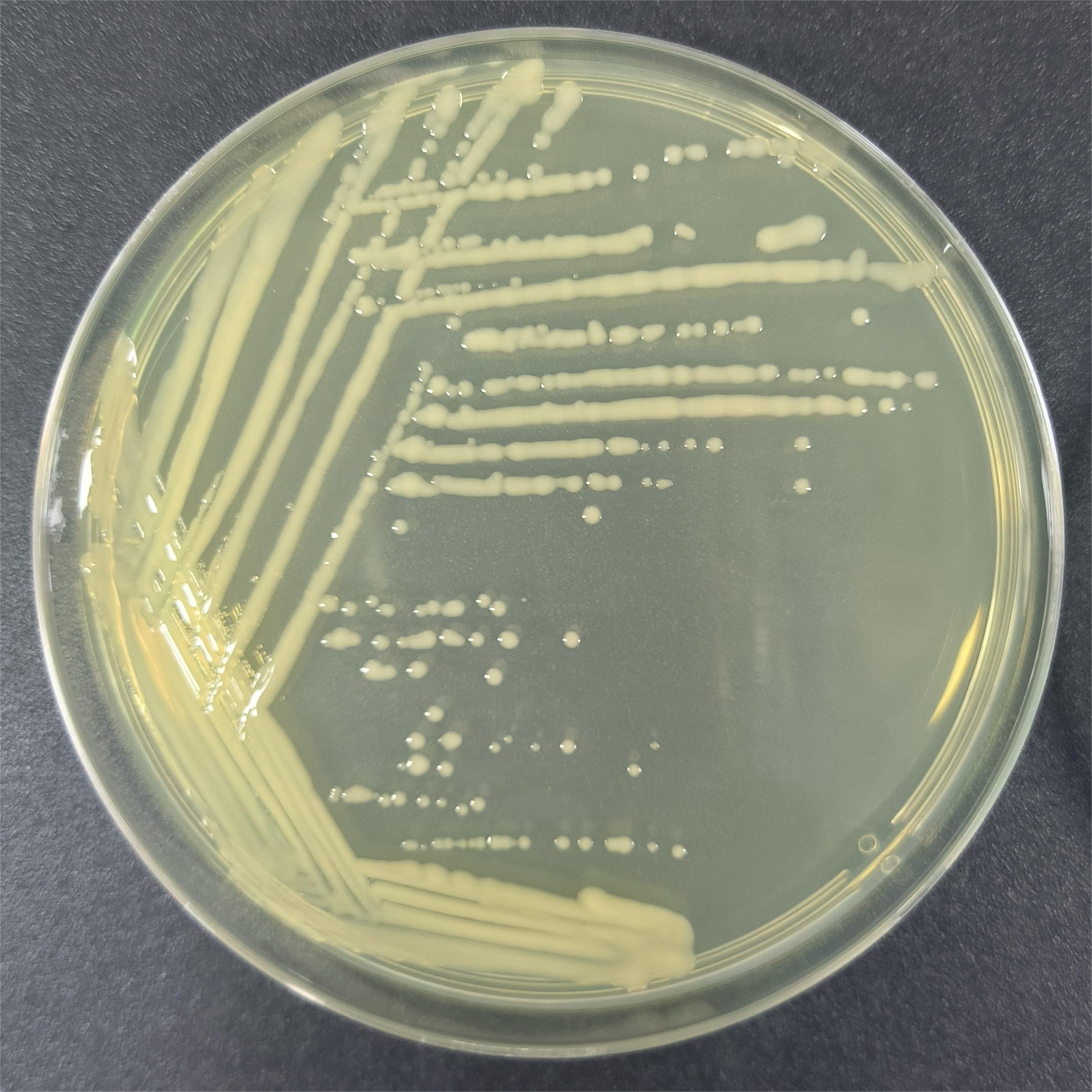 Pseudomonas aeruginosa-BNCC